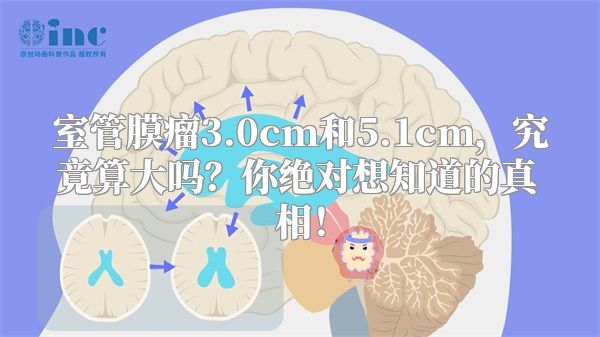 室管膜瘤3.0cm和5.1cm，究竟算大吗？你绝对想知道的真相！