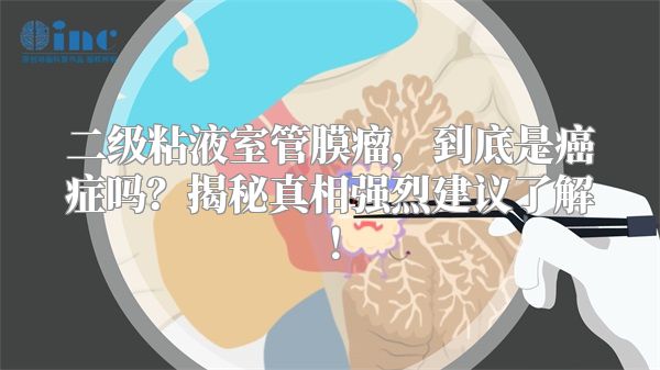 二级粘液室管膜瘤，到底是癌症吗？揭秘真相强烈建议了解！