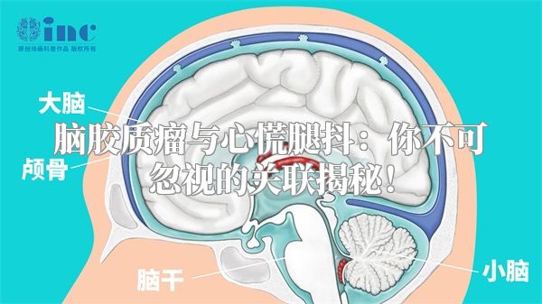 脑胶质瘤与心慌腿抖：你不可忽视的关联揭秘！