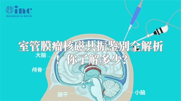 室管膜瘤核磁共振鉴别全解析！你了解多少？