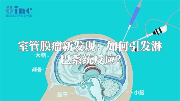 室管膜瘤新发现：如何引发淋巴系统反应？
