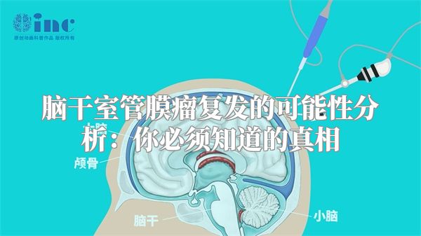 脑干室管膜瘤复发的可能性分析：你必须知道的真相