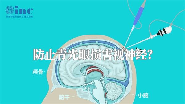 防止青光眼损害视神经?