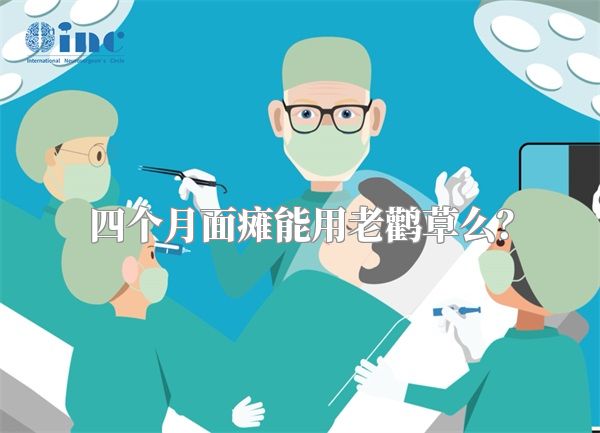 四个月面瘫能用老鹳草么？