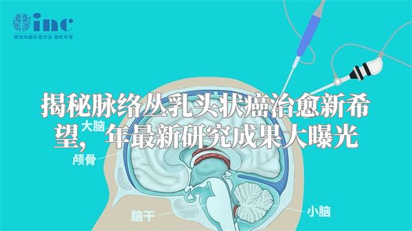 揭秘脉络丛乳头状癌治愈新希望，年最新研究成果大曝光