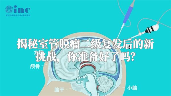 揭秘室管膜瘤二级复发后的新挑战，你准备好了吗？
