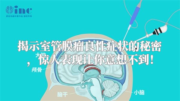 揭示室管膜瘤良性症状的秘密，惊人表现让你意想不到！
