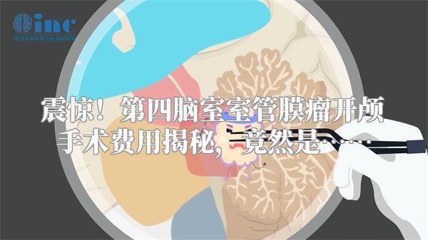 震惊！第四脑室室管膜瘤开颅手术费用揭秘，竟然是……