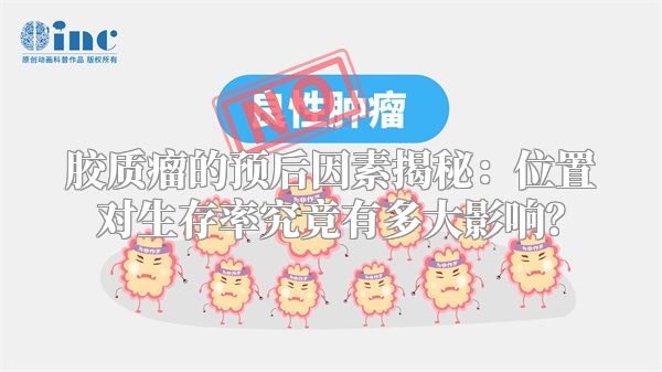 胶质瘤的预后因素揭秘：位置对生存率究竟有多大影响？