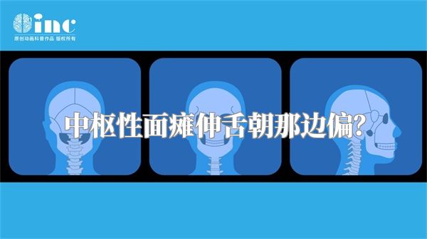 中枢性面瘫伸舌朝那边偏？