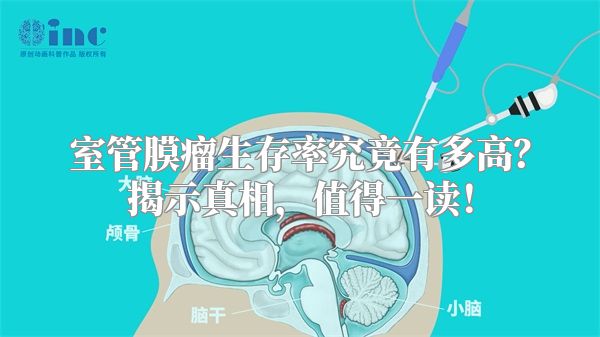 室管膜瘤生存率究竟有多高？揭示真相，值得一读！