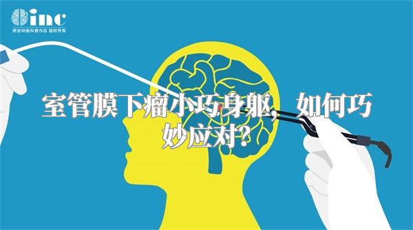 室管膜下瘤小巧身躯，如何巧妙应对？