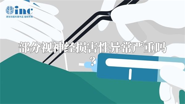 部分视神经损害性异常严重吗？