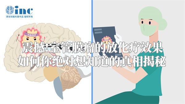 震撼!室管膜瘤的放化疗效果如何你绝对想知道的真相揭秘