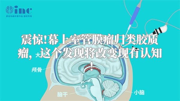 震惊!幕上室管膜瘤归类胶质瘤，这个发现将改变现有认知！