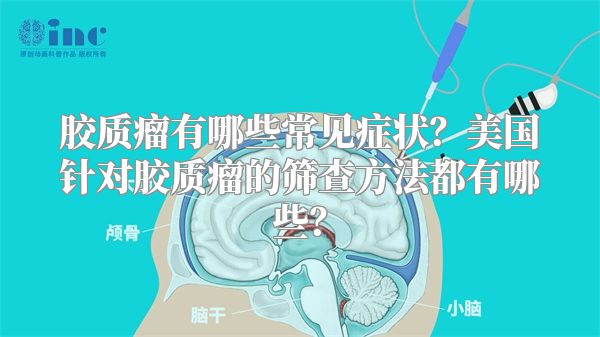 胶质瘤有哪些常见症状？美国针对胶质瘤的筛查方法都有哪些？