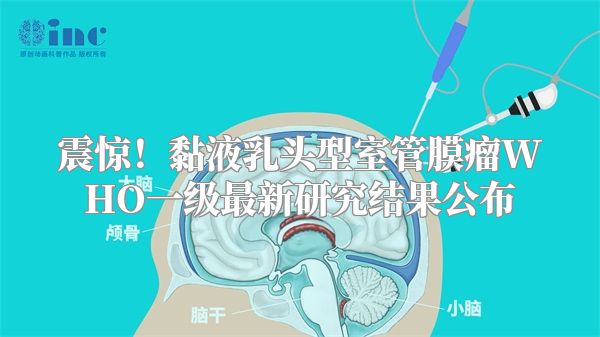 震惊！黏液乳头型室管膜瘤WHO一级最新研究结果公布