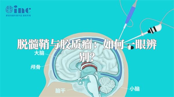 脱髓鞘与胶质瘤：如何一眼辨别？