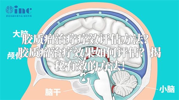 胶质瘤治疗疗效评估方法？ 胶质瘤治疗效果如何评估？揭秘有效的方法！