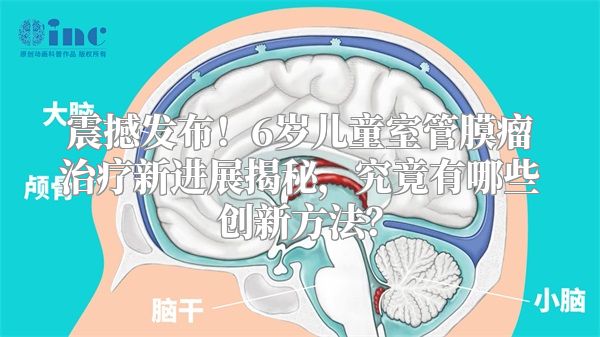 震撼发布！6岁儿童室管膜瘤治疗新进展揭秘，究竟有哪些创新方法？