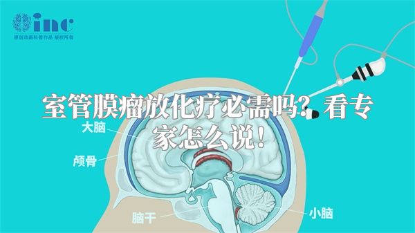 室管膜瘤放化疗必需吗？看专家怎么说！