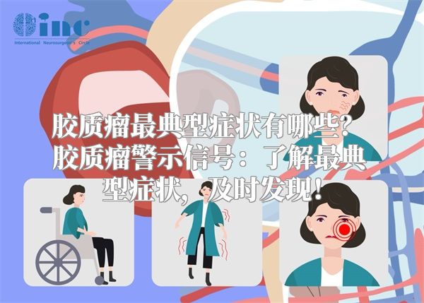 胶质瘤最典型症状有哪些？ 胶质瘤警示信号：了解最典型症状，及时发现！