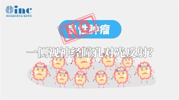 一侧视神经瞳孔对光反射？