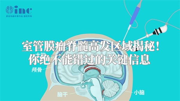 室管膜瘤脊髓高发区域揭秘！你绝不能错过的关键信息