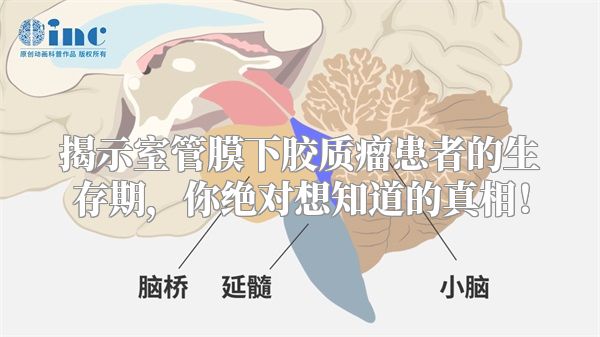 揭示室管膜下胶质瘤患者的生存期，你绝对想知道的真相！