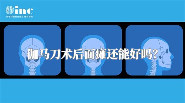 伽马刀术后面瘫还能好吗？