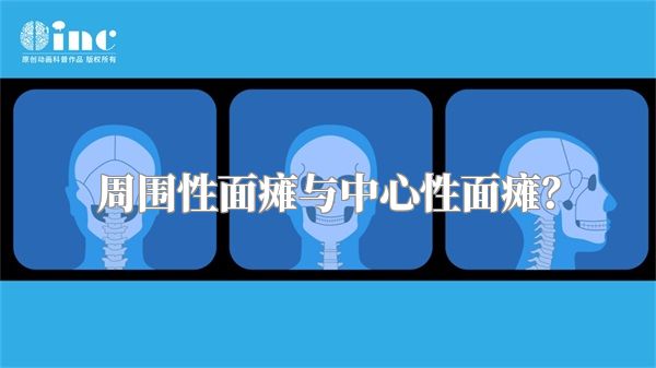 周围性面瘫与中心性面瘫？