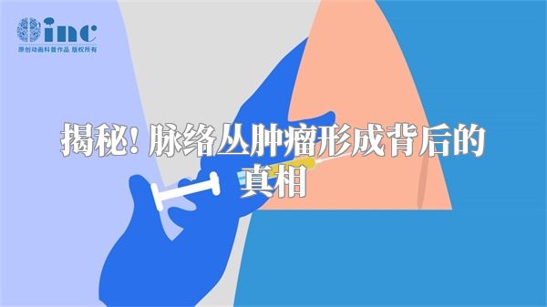 揭秘! 脉络丛肿瘤形成背后的真相