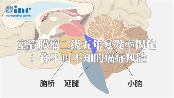 室管膜瘤二级五年复发率揭秘：你不可不知的癌症风险
