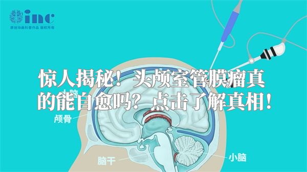 惊人揭秘！头颅室管膜瘤真的能自愈吗？点击了解真相！