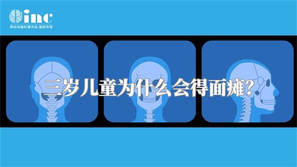 三岁儿童为什么会得面瘫？