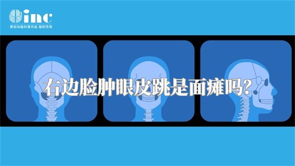 右边脸肿眼皮跳是面瘫吗？