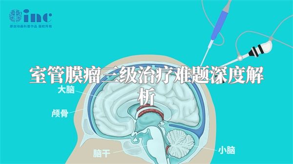 室管膜瘤三级治疗难题深度解析