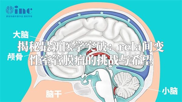 揭秘最新医学突破：rela间变性室管膜瘤的挑战与希望
