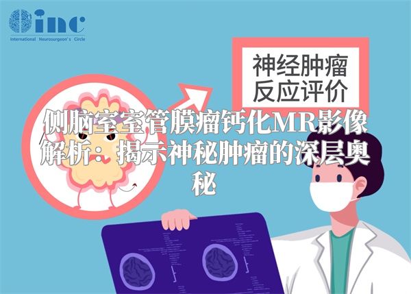 侧脑室室管膜瘤钙化MR影像解析：揭示神秘肿瘤的深层奥秘