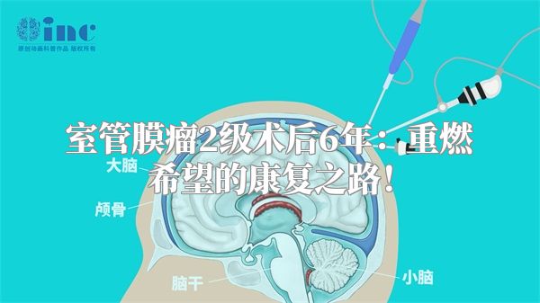 室管膜瘤2级术后6年：重燃希望的康复之路！