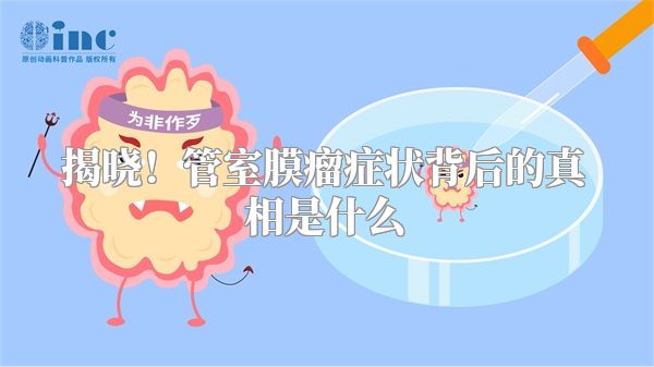 揭晓！管室膜瘤症状背后的真相是什么