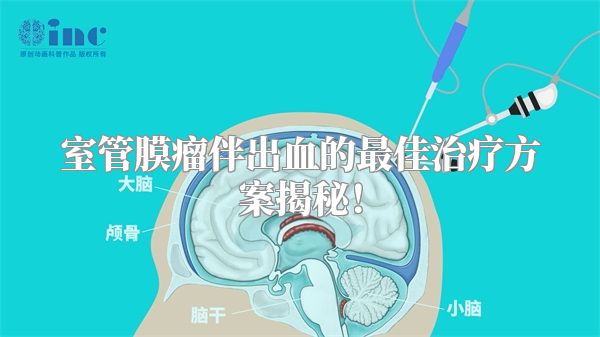 室管膜瘤伴出血的最佳治疗方案揭秘！