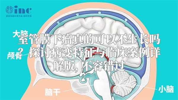 室管膜下瘤真的可以不生长吗？探讨病变特征与临床案例详解版, 不容错过