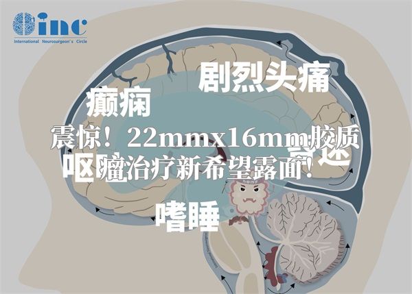 震惊！22mmx16mm胶质瘤治疗新希望露面！
