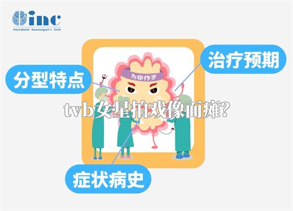 tvb女星拍戏像面瘫？