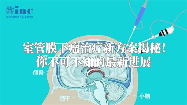 室管膜下瘤治疗新方案揭秘！你不可不知的最新进展