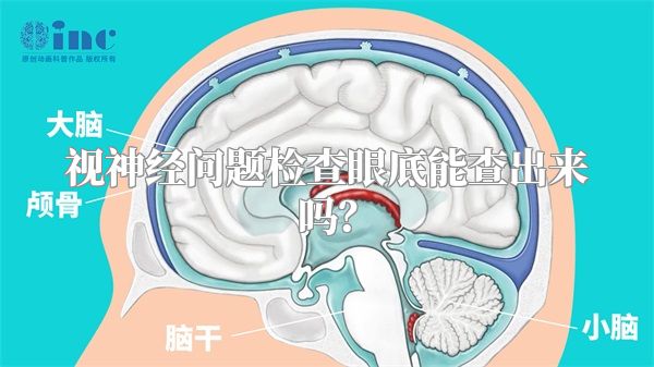 视神经问题检查眼底能查出来吗？