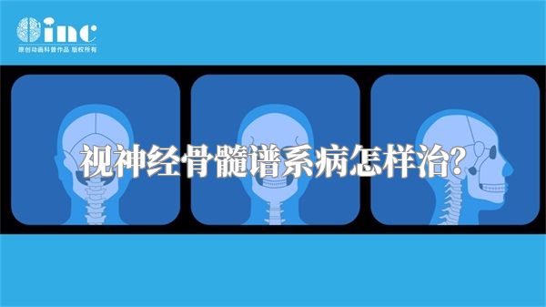 视神经骨髓谱系病怎样治？