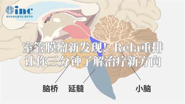 室管膜瘤新发现！Rela重排让你三分钟了解治疗新方向