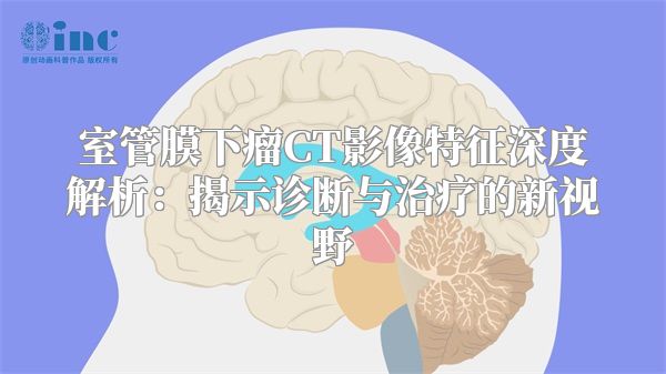 室管膜下瘤CT影像特征深度解析：揭示诊断与治疗的新视野
